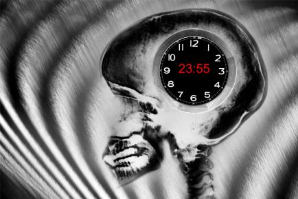X-RAY-CLOCK-1060-33-77-AA