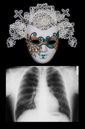 X-RAY-Z704-33333-2222-AA