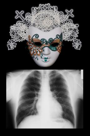 X-RAY-Z704-33333-2222-AA